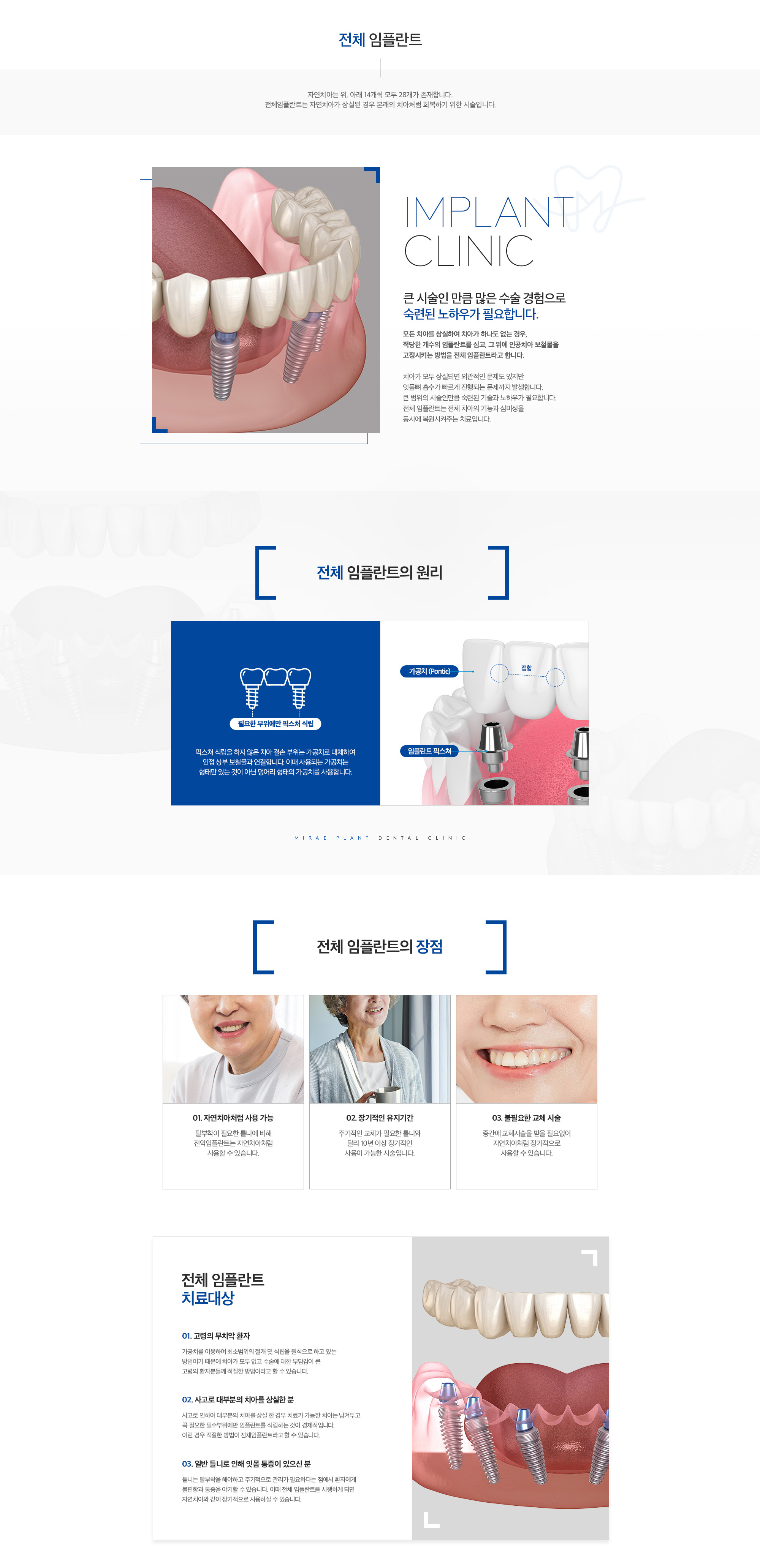 미래플란트치과 전체 임플란트 안내 - 원리, 장점, 치료대상