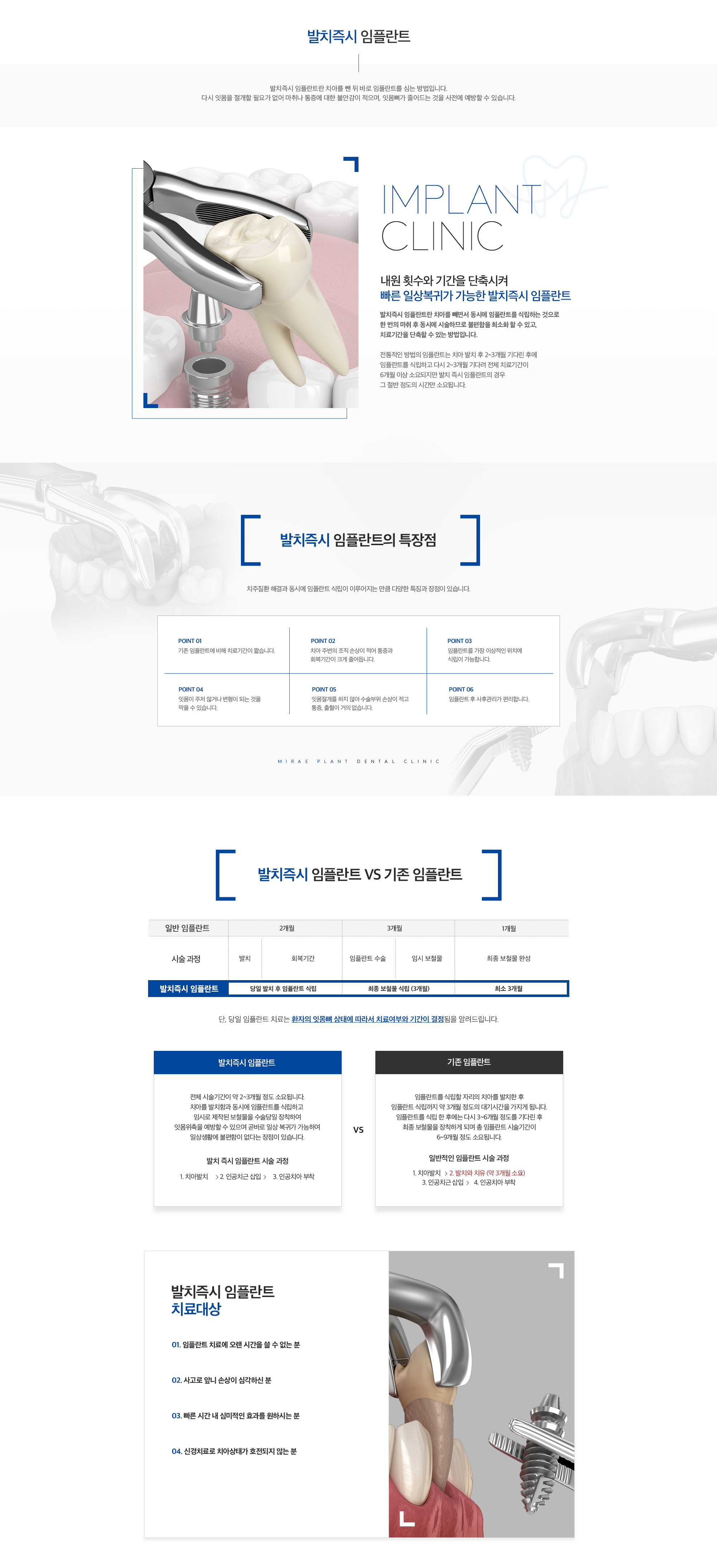 미래플란트치과 발치즉시 임플란트 안내 - 특장점, 치료 대상