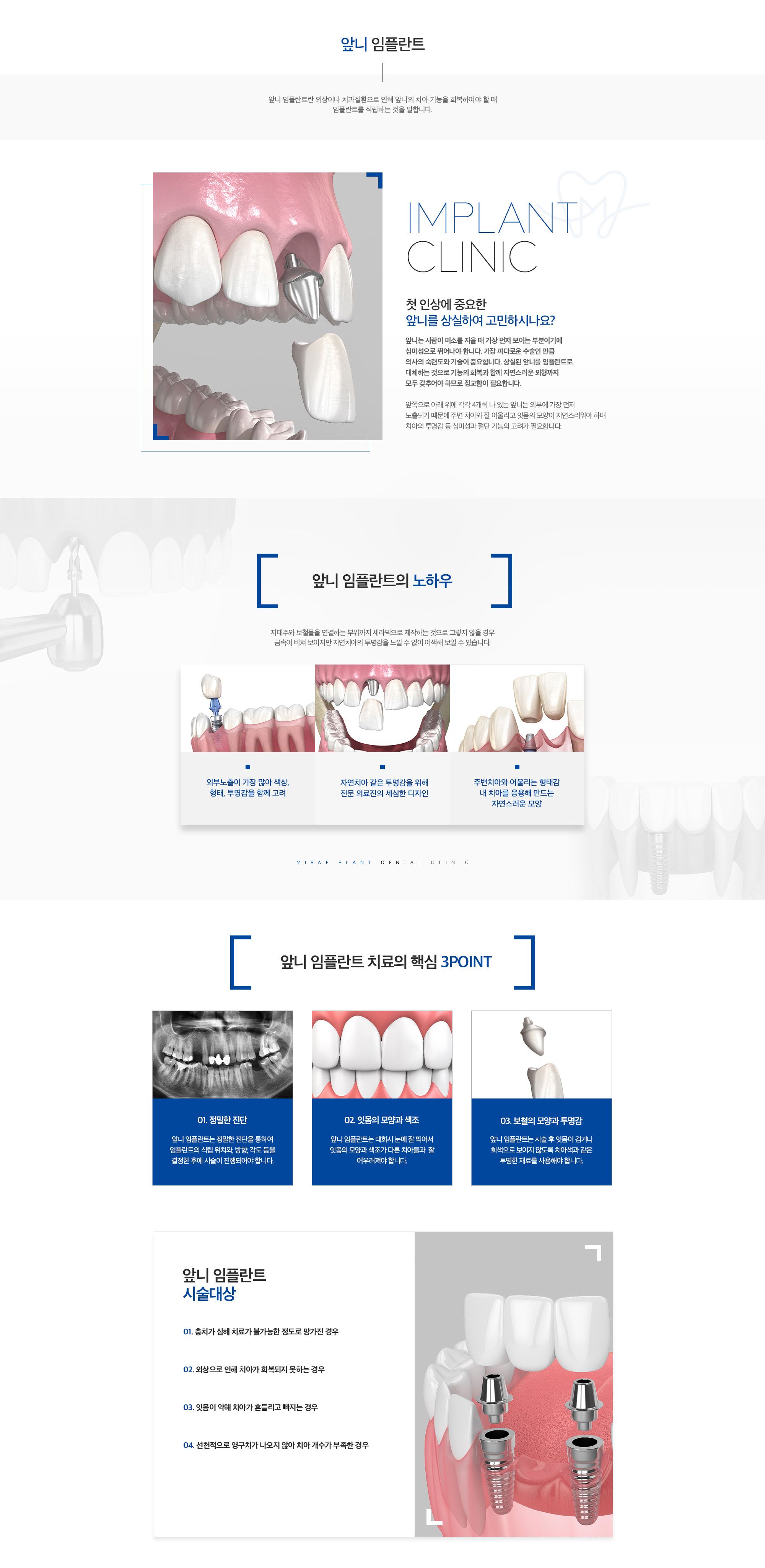 미래플란트치과 앞니 임플란트 안내 - 심미 디자인, 핵심 포인트, 치료 대상