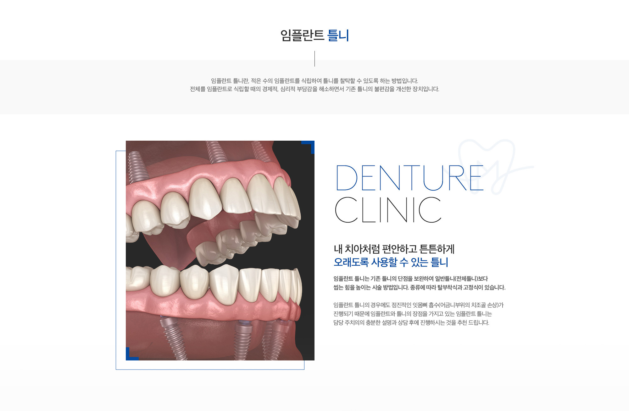 미래플란트치과 보험 임플란트, 틀니 및 오버덴처 치료 안내
