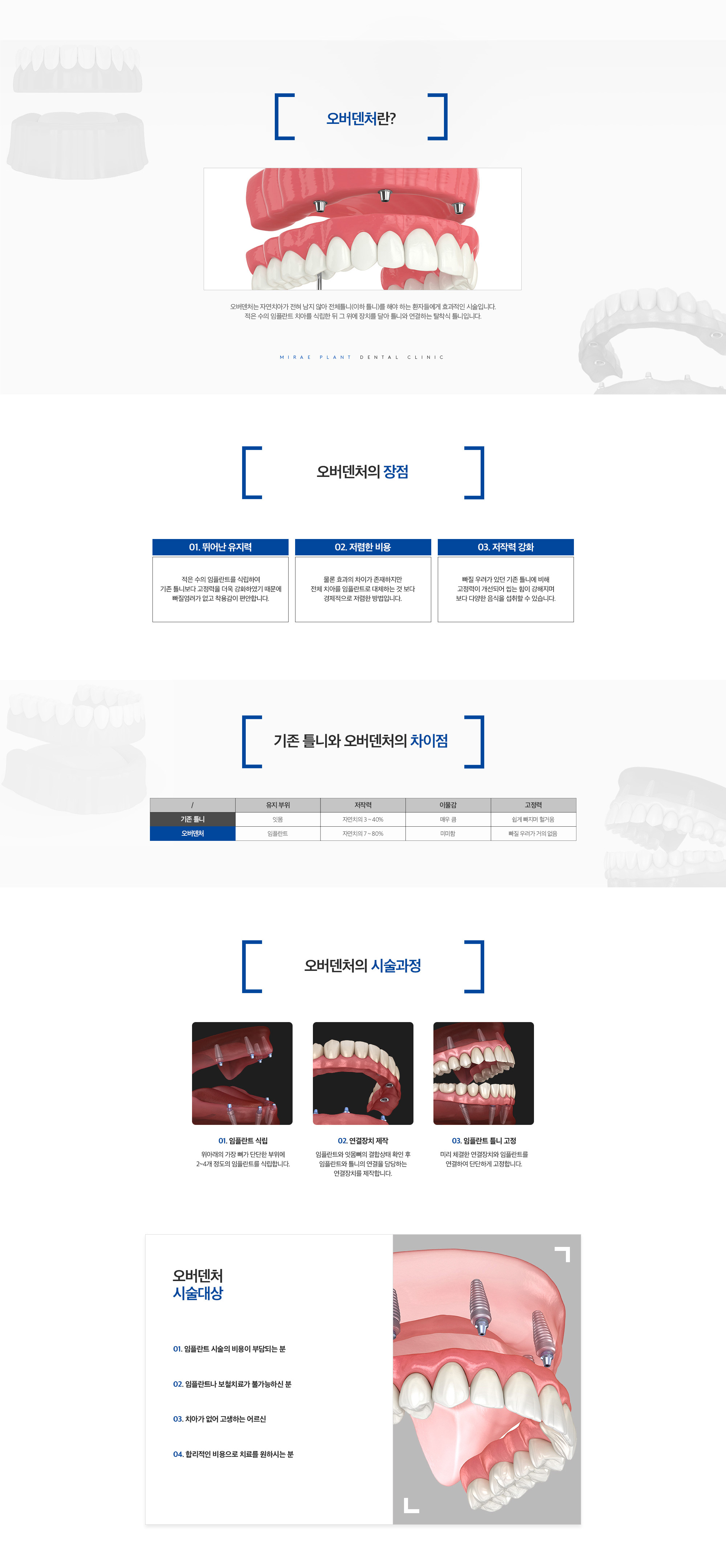 오버덴처 치료 구조 예시