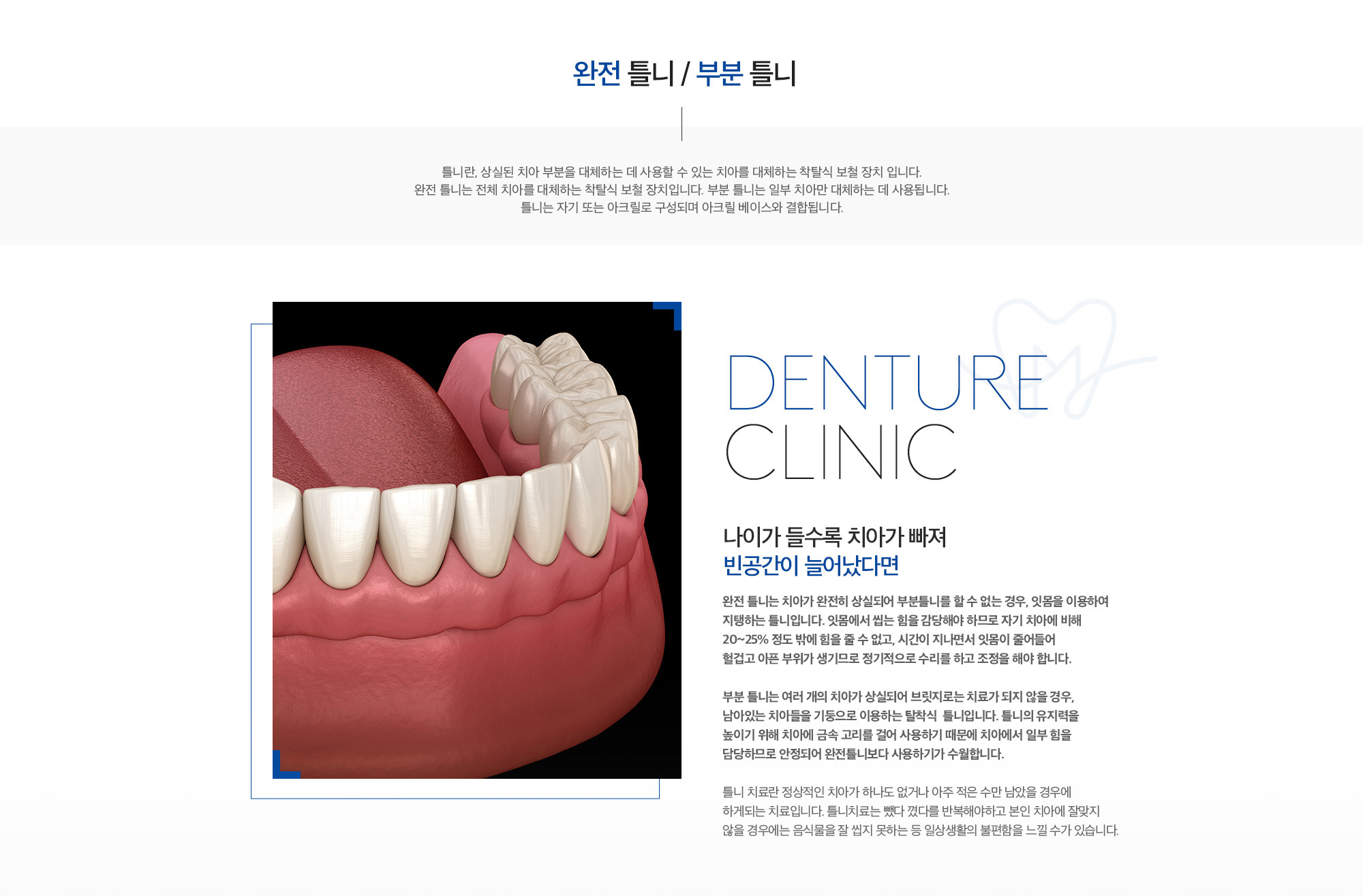 미래플란트치과 완전틀니와 부분틀니 안내 - 차이점과 사용 시 주의사항