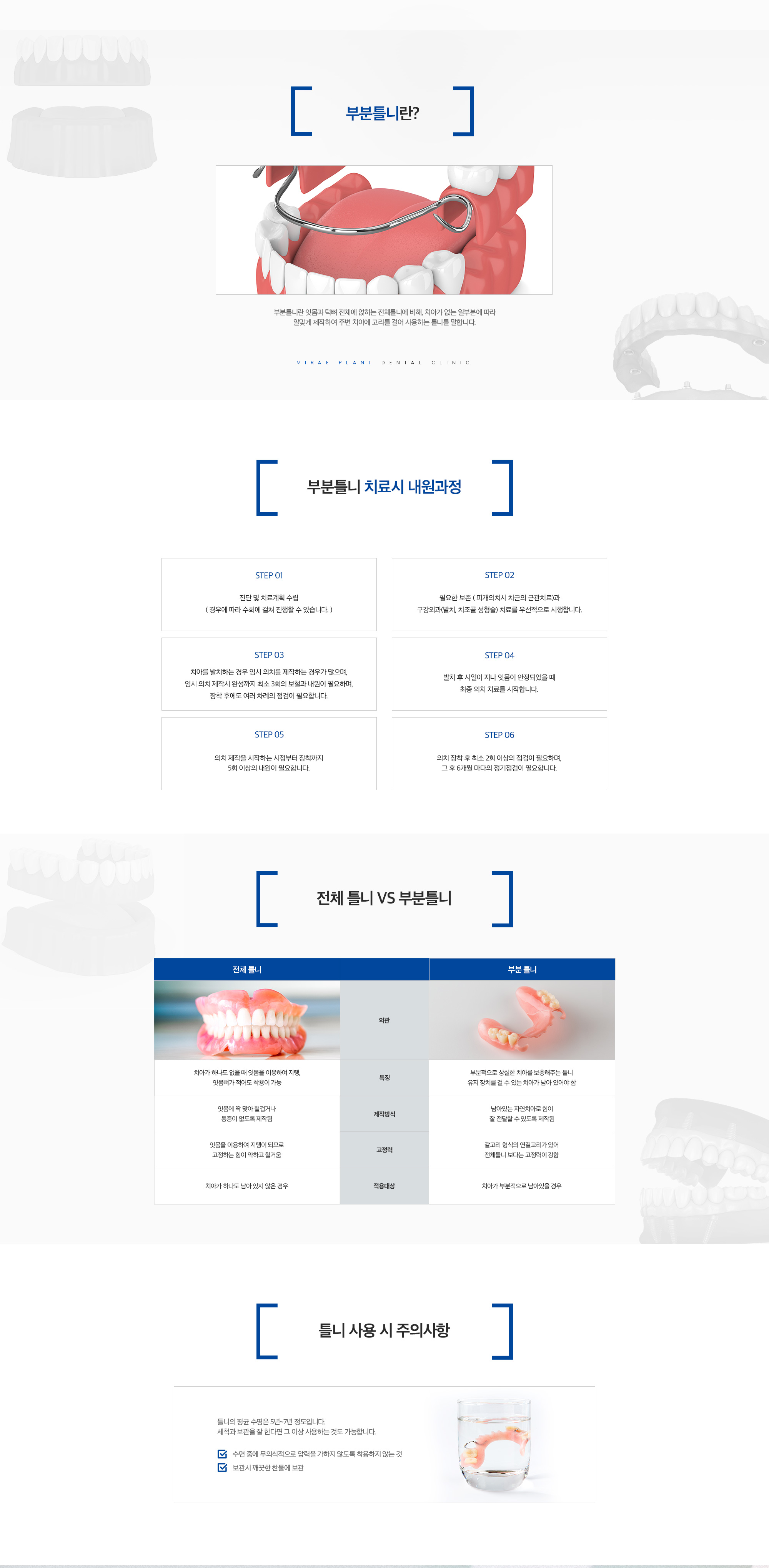 부분틀니 안내 이미지