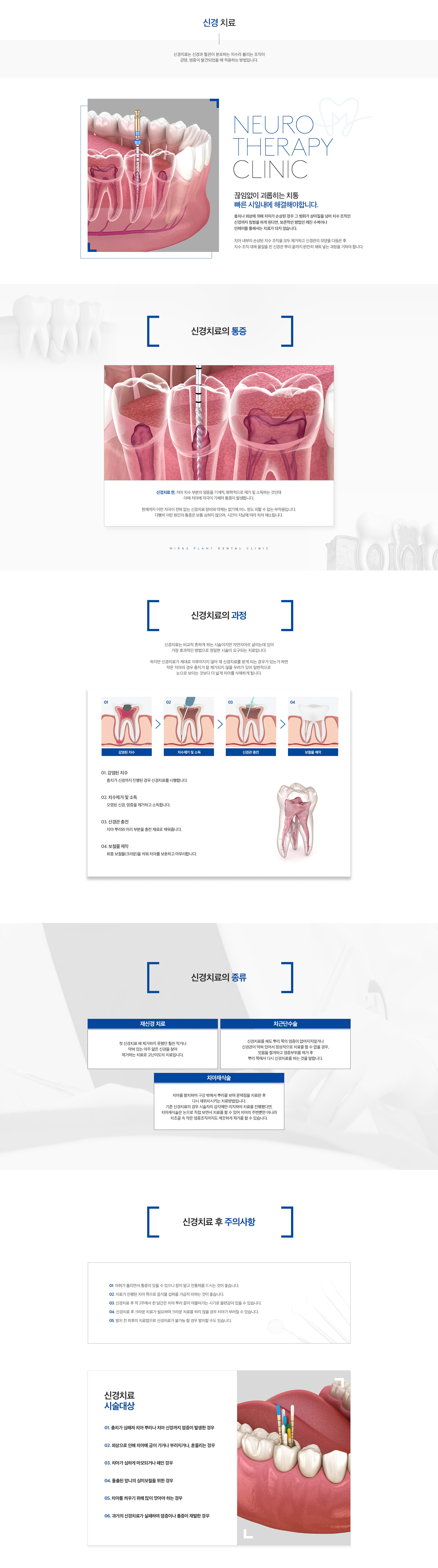 미래플란트치과 신경치료 안내 - 치료 과정, 종류, 주의사항
