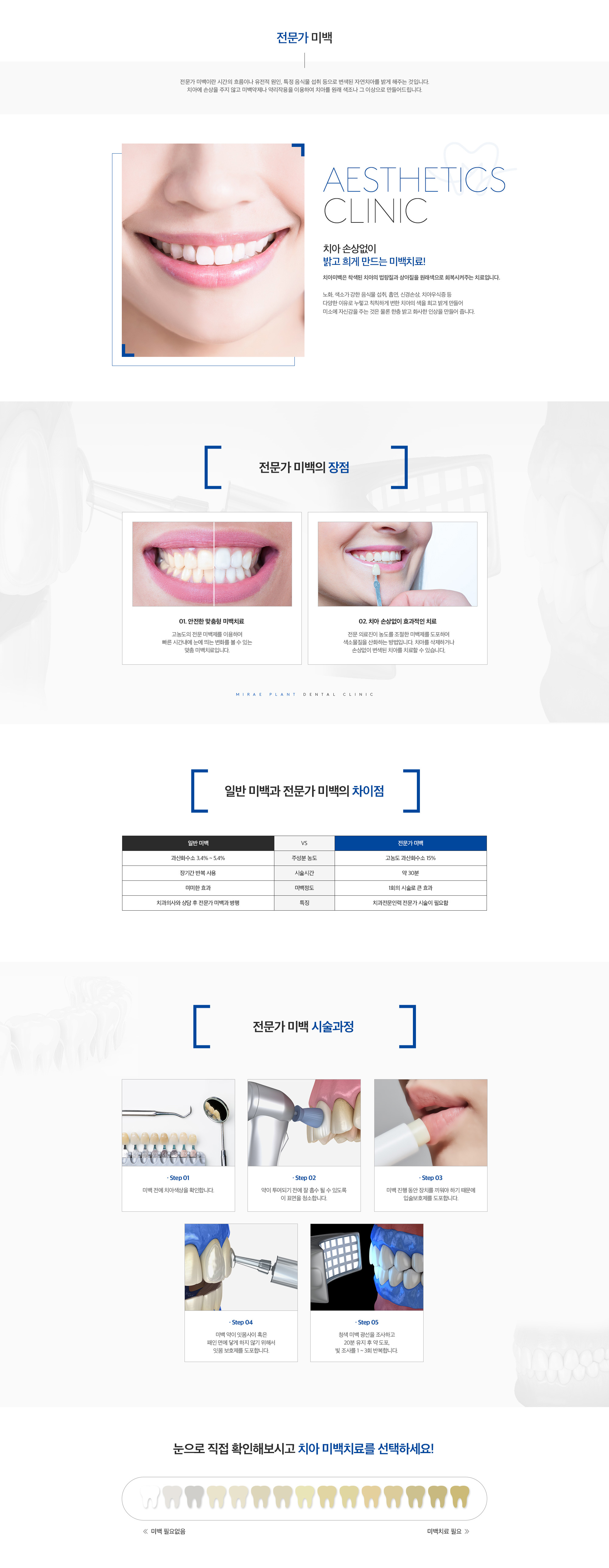 미래플란트치과 전문가 미백 안내 - 시술 장점, 일반 미백과 차이, 진행 과정