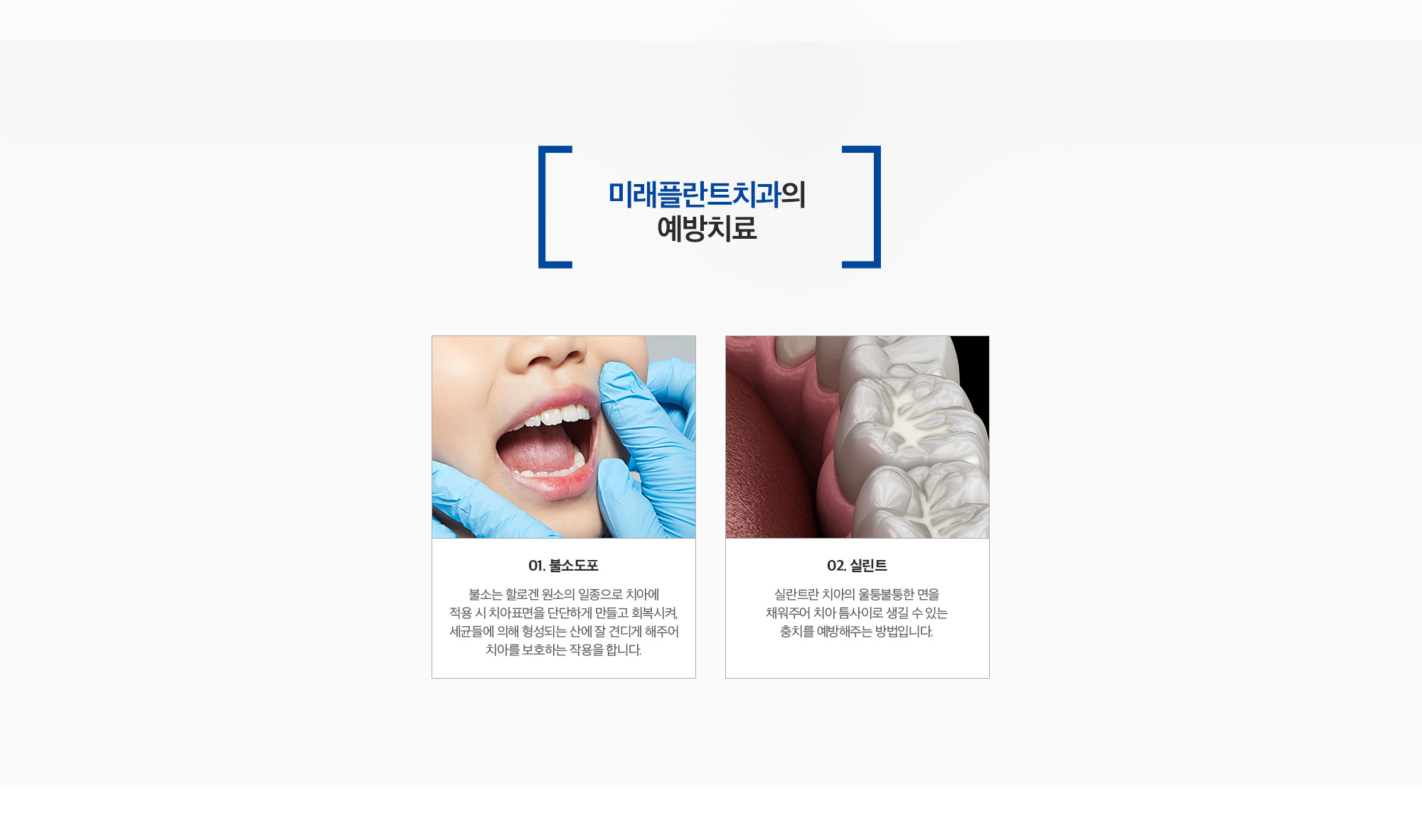 예방치료 안내 - 불소도포, 실란트