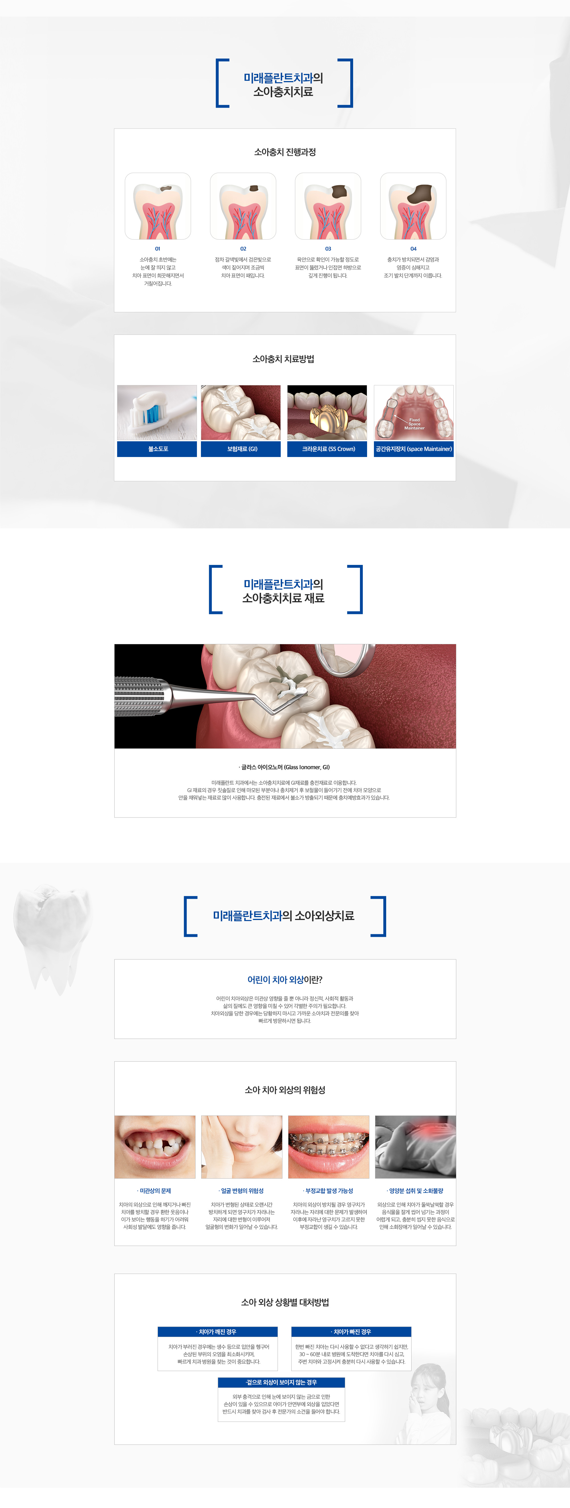 소아충치치료 안내 - GI, 크라운, 공간유지장치
