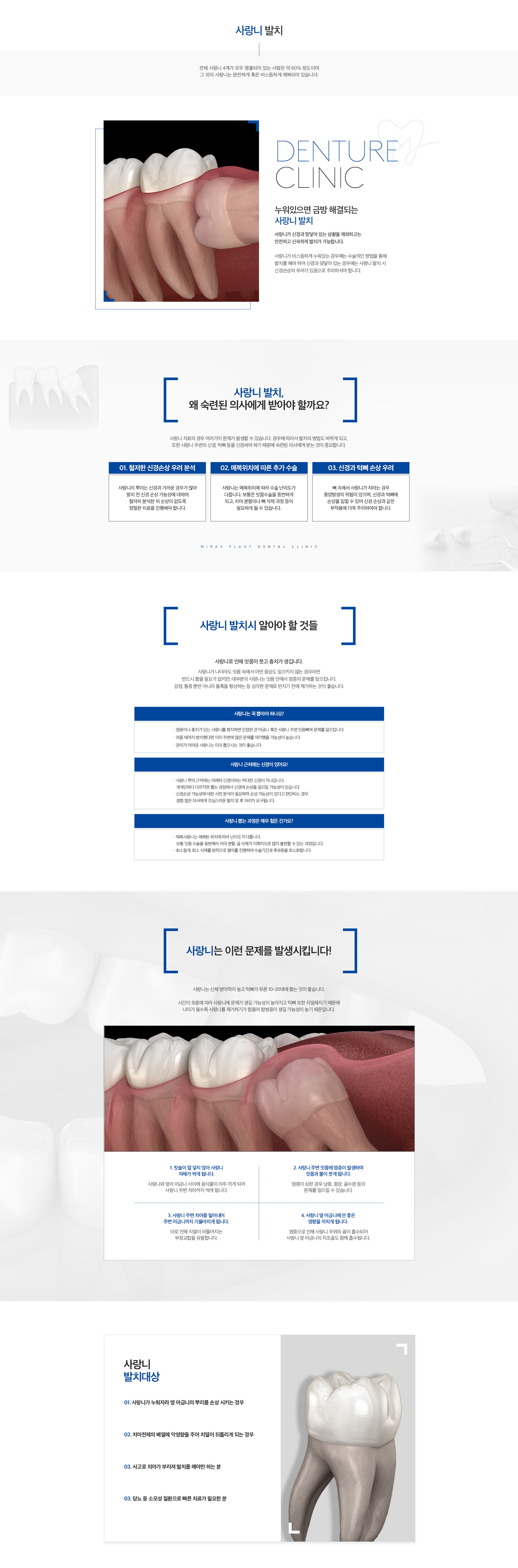 미래플란트치과 사랑니 발치 안내 - 매복 사랑니, 발치 필요 상황, 주의사항