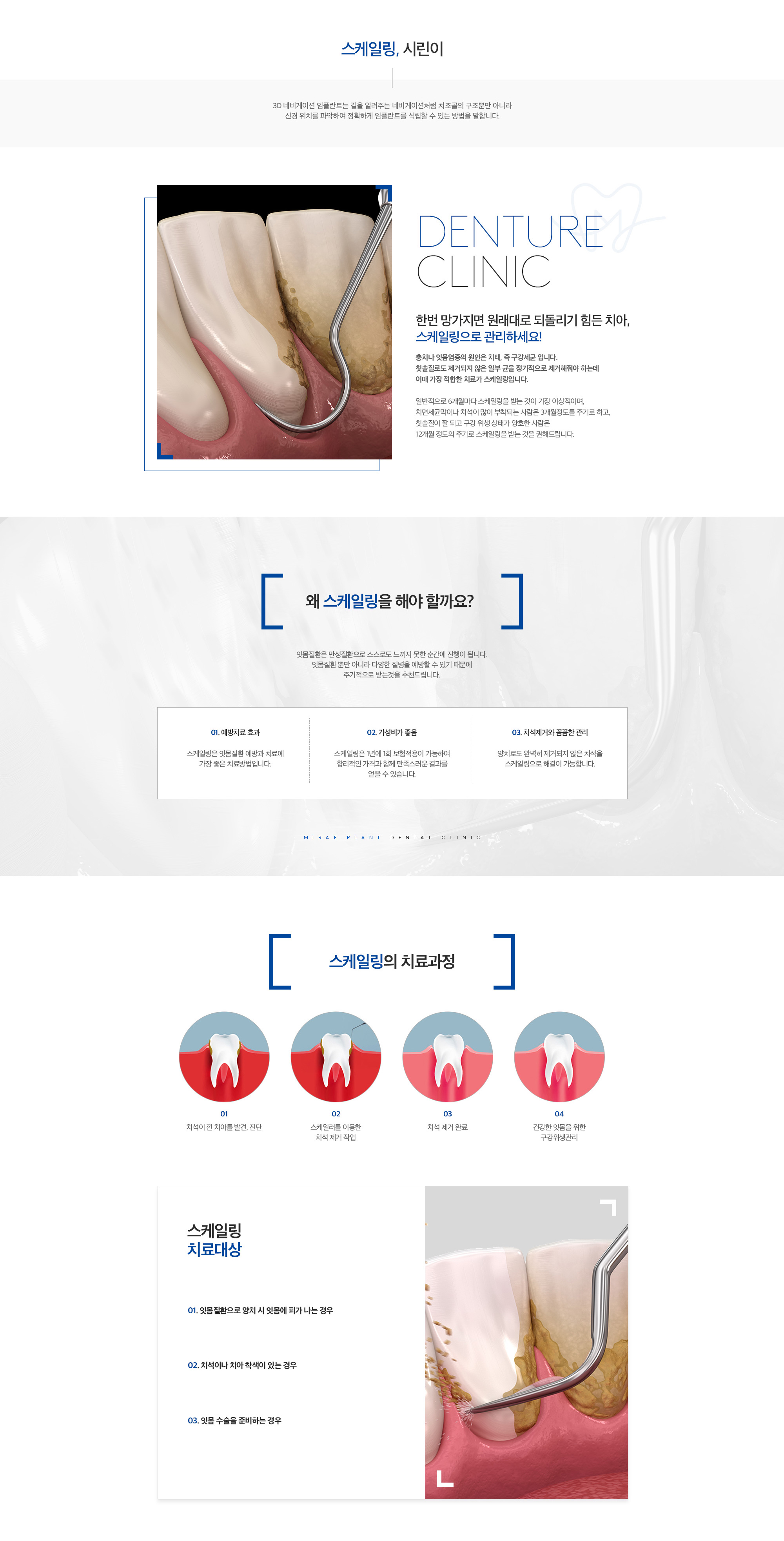 미래플란트치과 스케일링 및 시린이 안내 - 필요성, 과정, 대상